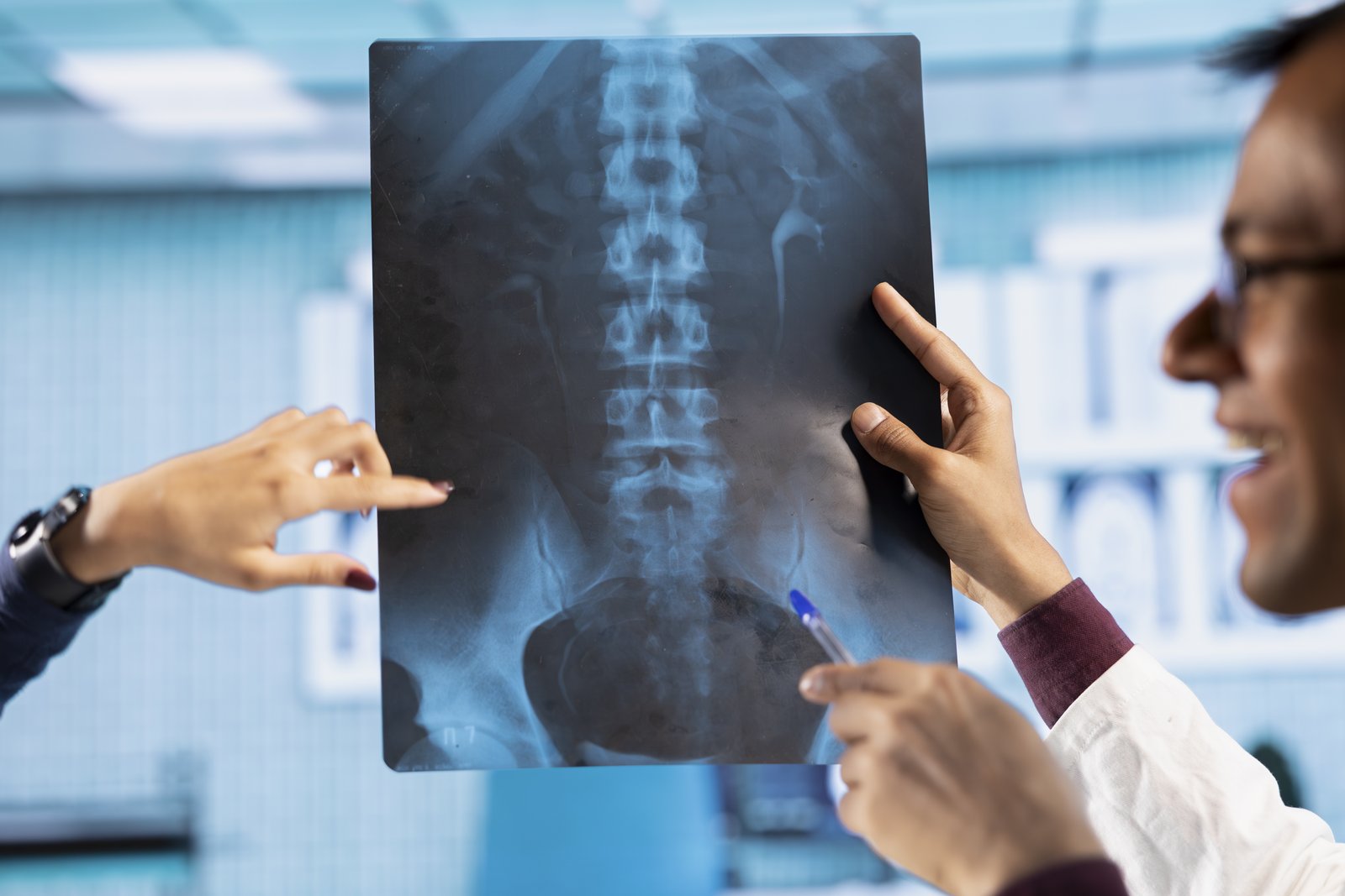A clinician holding up a lumbar spine X-ray